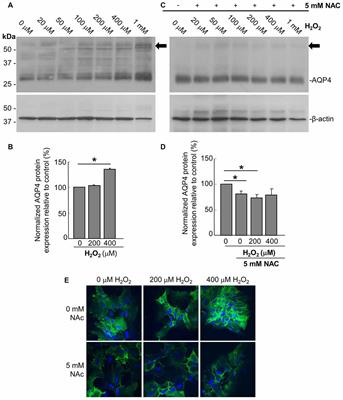 The Oxidative Stress-Induced Increase in the Membrane Expression of the Water-Permeable Channel Aquaporin-4 in Astrocytes Is Regulated by Caveolin-1 Phosphorylation